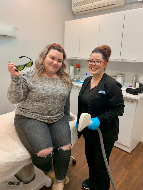 Chicago Plus Size Petite Fashion Blogger, influencer, YouTuber, and model Natalie Craig, of Natalie in the City, gets laser hair removal on her lip and chin at SpaDerma med spa in Chicago. Will it work if she has polycystic ovarian syndrome?