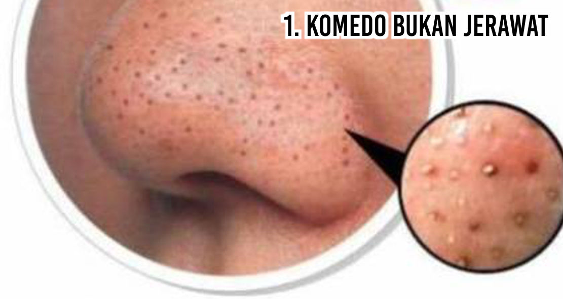 3 fakta komedo yang harus kamu ketahui zeropromosi souvenir barang