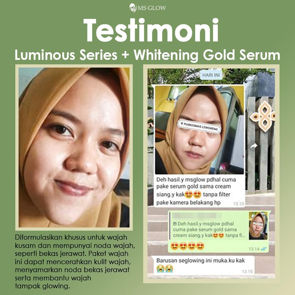 testimoni ms glow skin care