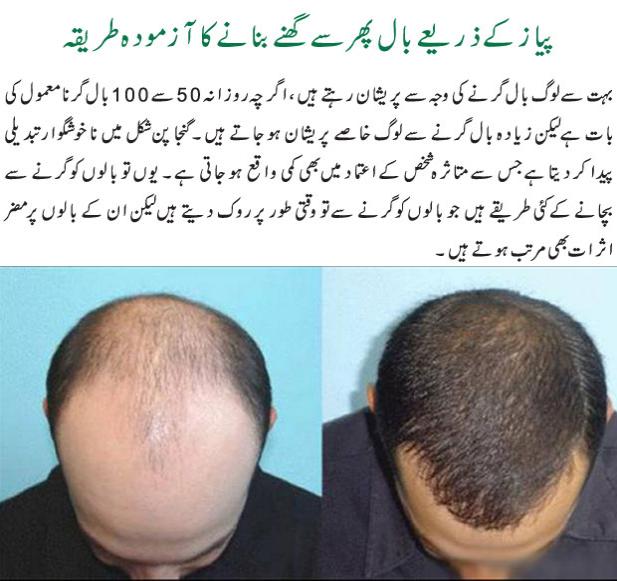 onion for hair growth