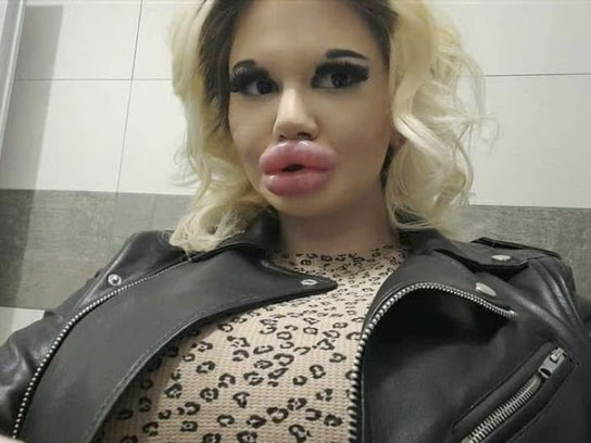Check out the Lady with the Biggest Lips in the World (photos)