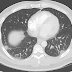 Covid-19: A Radiologist Perspective (11 Pics)