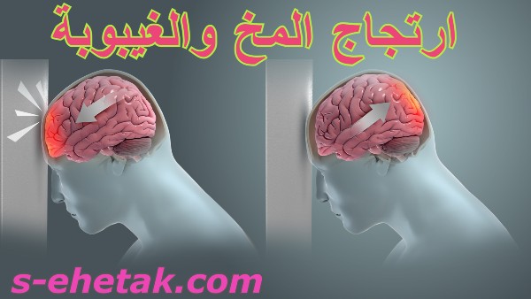 ارتجاج المخ والغيبوبة ارتجاج المخ والغيبوبة