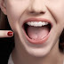 Niềng răng móm và những vấn đề liên quan