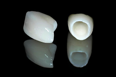 Thông tin về răng sứ cao cấp 