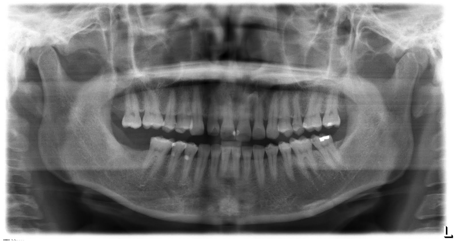 Rigby Advanced Dental Today's Implant Placement