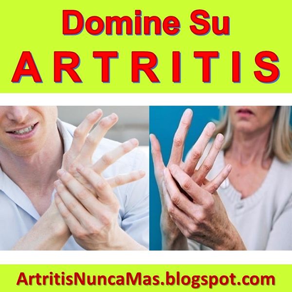 medicina-natural-para-la-artritis-reumatoide-osteoartritis-degenerativa