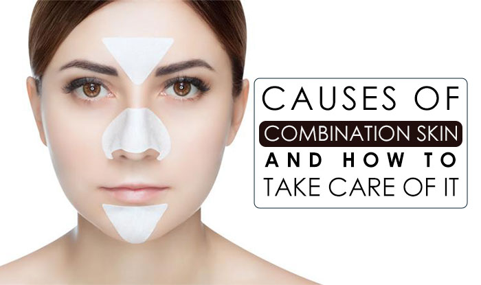 Causes of Combination Skin and How to take Care of it