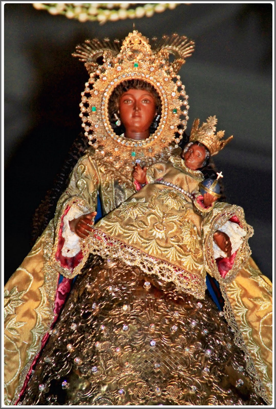 adenom de prostata imagini