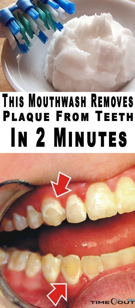 This Mouthwash Removes Plaque From Teeth In 2 Minutes Wellness Click