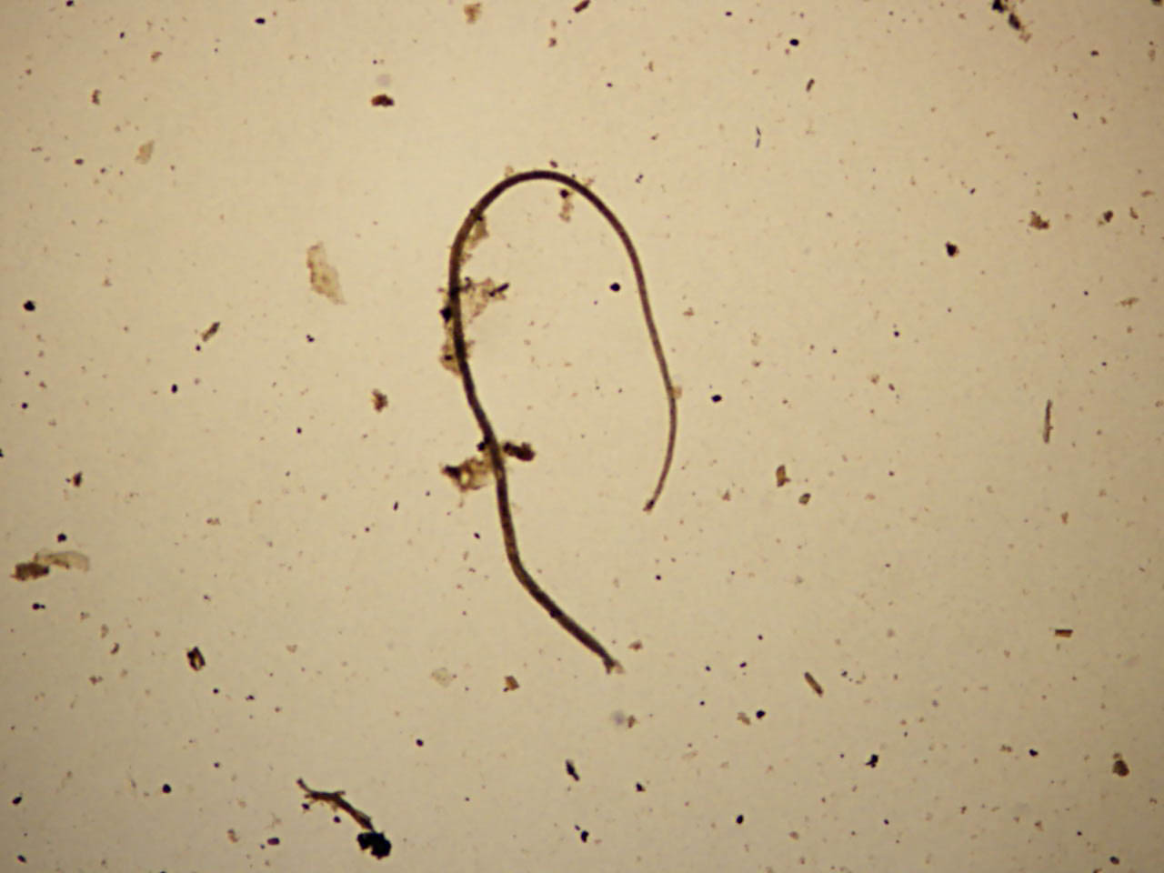 Creepy Dreadful Wonderful Parasites: Case of the Week 445