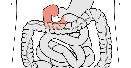 According2Robyn: Digestive System, Part 5: The Duodenum