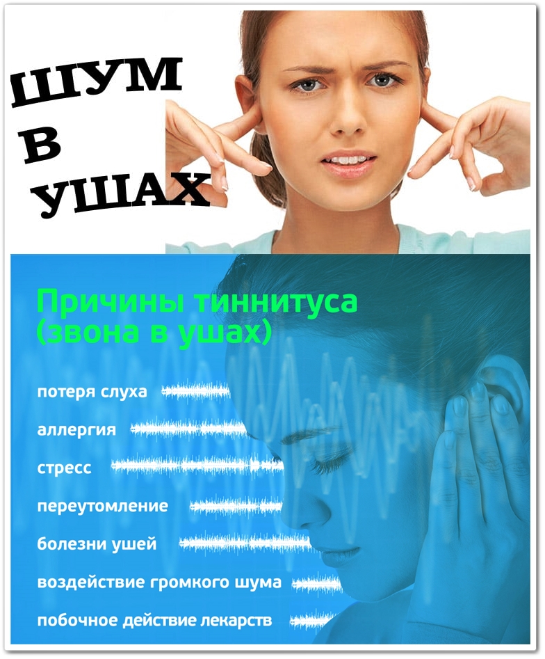 Таблетки от звона в ушах. Лекарство от шума и звона в ушах и голове. Шум в голове лекарства.