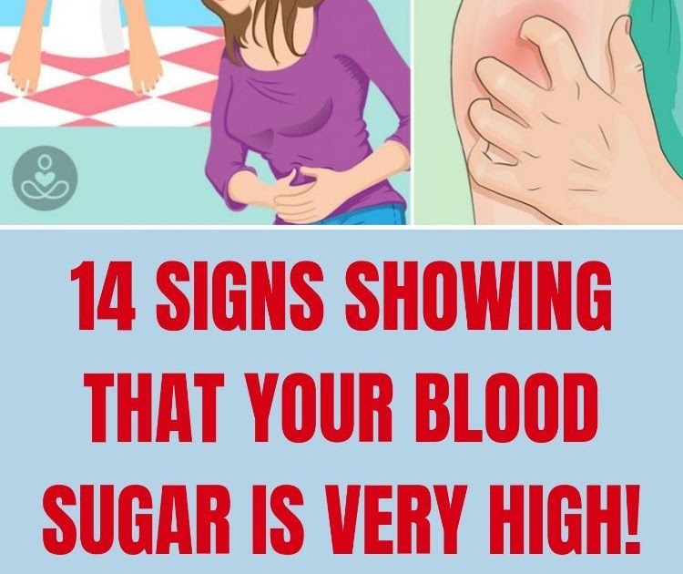 Signs Showing That Your Blood Sugar Is Very High Wellness Topic