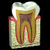 Bọc răng sứ cho răng chết tủy có nguy hiểm không?