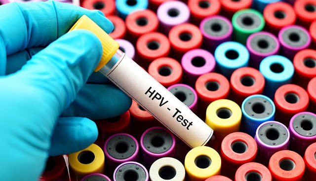Test de Virus del Papiloma Humano