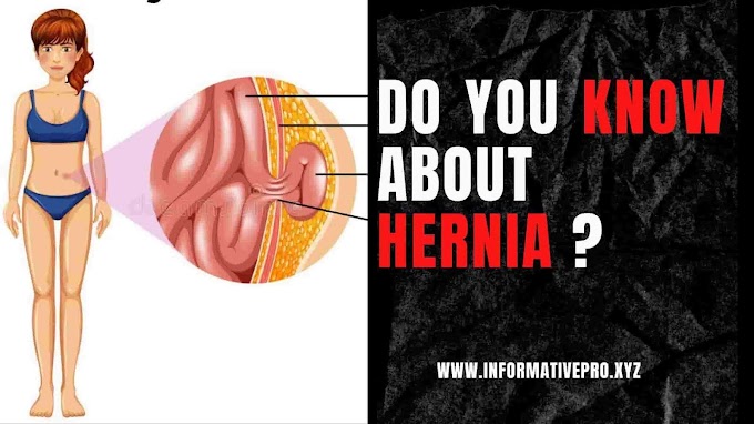 Do you know about a hernia?
