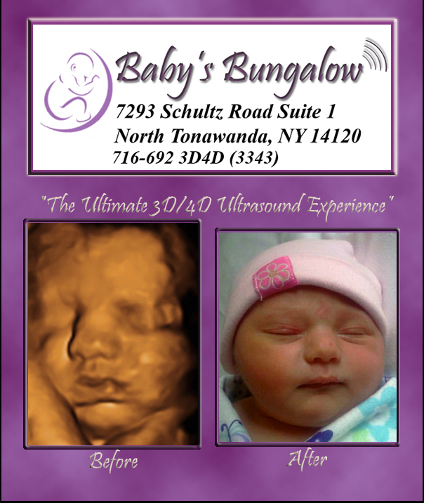 Baby's Bungalow 3D Ultrasound Buffalo 4D Ultrasound