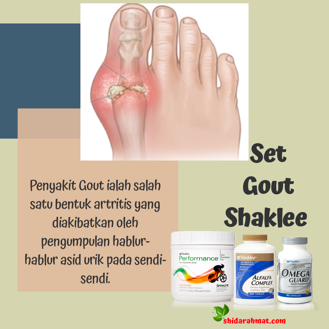 Bahaya Penyakit Gout Shida Rahmat