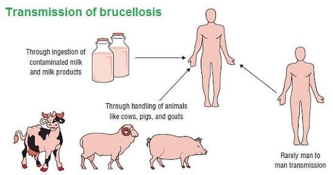 Brucellosis ( Brucella infection in humans: Mediterranean fever, Malta fever )