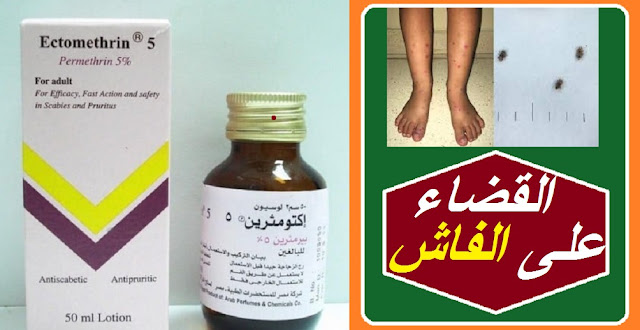"حشرة الفاش في المنزل" "القضاء على الفاش نهائيا من المنزل" "هل الكلور يقتل الفاش" "حشرة الفاش والانسان" "شكل الفاش الأبيض" "التخلص من الفاش نهائيا من المنزل" "كيف اقضى على الفاش في المنزل" "هل فاش الطيور يعدى الانسان" حشرة الفاش ويكيبيديا " حشرة الفاش الأبيض في المنزل" حشرة الفاش الأبيض" حشرة الفاش" " علاج حشرة الفاش " فاش الطيور حشرة الفاش" حشرة الفاش الابيض 0" حشرة الفاش في المنزل" حشرة الفاش في الطيور" حشرة العلقة" حشرة الجرب" حشرة الحمام" حشرة قمل الحمام" " ما هي حشرة الفاش" حشرة الفاش فى المنزل" حشرة الفاش والانسان" حشرة فاش الحمام" " شكل حشرة الجرب" حشرة الفاش فاش الحمام" حشرة البغبش" حشرة الفاش الأسود" حشرة القميلة" شكل حشرة الفاش" كيفية التخلص من حشرة الفاش فى المنزل" شكل حشرة فاش الطيور" فاش شكل حشرة الفاش" الارنب حشرة" أضرار حشرة السوس" هل الخل يقتل الفاش التخلص من الفاش نهائيا القضاء على الفاش من المنزل القضاء على الفاش نهائيا من المنزل علاج الفاش بالحلبه علاج الفاش عند الانسان علاج الفاش بالثوم هل الفاش ينتقل للانسان حشرة الفاش في المنزل القضاء على الفاش نهائيا من المنزل الفاش الابيض هل الكلور يقتل الفاش شكل الفاش الأبيض كيف اقضى على الفاش في المنزل التخلص من الفاش نهائيا من المنزل علاج قرص الفاش للانسان "حشرة الفاش في المنزل" "القضاء على الفاش نهائيا من المنزل" "هل الكلور يقتل الفاش" "حشرة الفاش والانسان" "شكل الفاش الأبيض" "التخلص من الفاش نهائيا من المنزل" "كيف اقضى على الفاش في المنزل" "هل فاش الطيور يعدى الانسان" حشرة الفاش ويكيبيديا " حشرة الفاش الأبيض في المنزل" حشرة الفاش الأبيض" حشرة الفاش" " علاج حشرة الفاش " فاش الطيور حشرة الفاش" حشرة الفاش الابيض 0" حشرة الفاش في المنزل" حشرة الفاش في الطيور" حشرة العلقة" حشرة الجرب" حشرة الحمام" حشرة قمل الحمام" " ما هي حشرة الفاش" حشرة الفاش فى المنزل" حشرة الفاش والانسان" حشرة فاش الحمام" " شكل حشرة الجرب" حشرة الفاش فاش الحمام" حشرة البغبش" حشرة الفاش الأسود" حشرة القميلة" شكل حشرة الفاش" كيفية التخلص من حشرة الفاش فى المنزل" شكل حشرة فاش الطيور" فاش شكل حشرة الفاش" الارنب حشرة" أضرار حشرة السوس" هل الخل يقتل الفاش التخلص من الفاش نهائيا القضاء على الفاش من المنزل القضاء على الفاش نهائيا من المنزل علاج الفاش بالحلبه علاج الفاش عند الانسان علاج الفاش بالثوم هل الفاش ينتقل للانسان حشرة الفاش في المنزل القضاء على الفاش نهائيا من المنزل الفاش الابيض هل الكلور يقتل الفاش شكل الفاش الأبيض كيف اقضى على الفاش في المنزل التخلص من الفاش نهائيا من المنزل علاج قرص الفاش للانسان