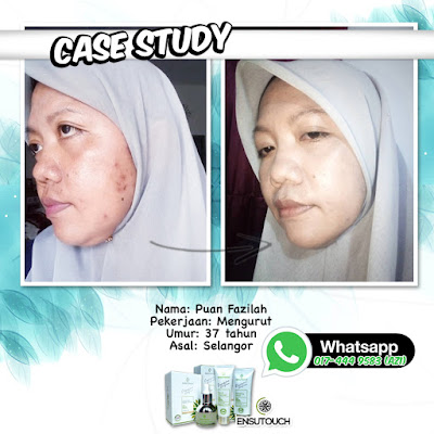 SKINCARE ENSUTOUCH