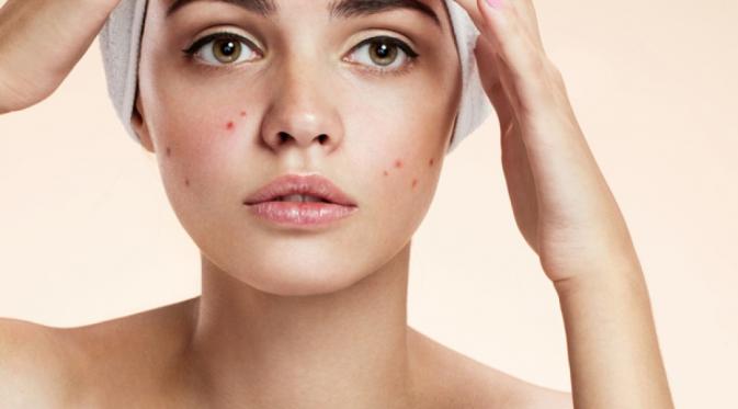 Hasil gambar untuk muka <a href='https://pontianak.tribunnews.com/tag/jerawat' title='jerawat'>jerawat</a>