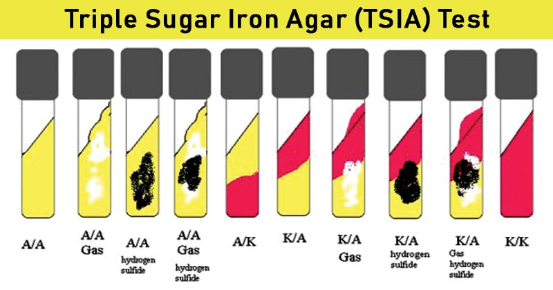 Triple Sugar Iron Test the-triple-sugar-iron-lab-the-triple-sugar-iron-tsi-test