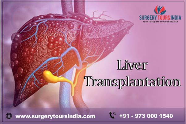 Liver Transplantation  India