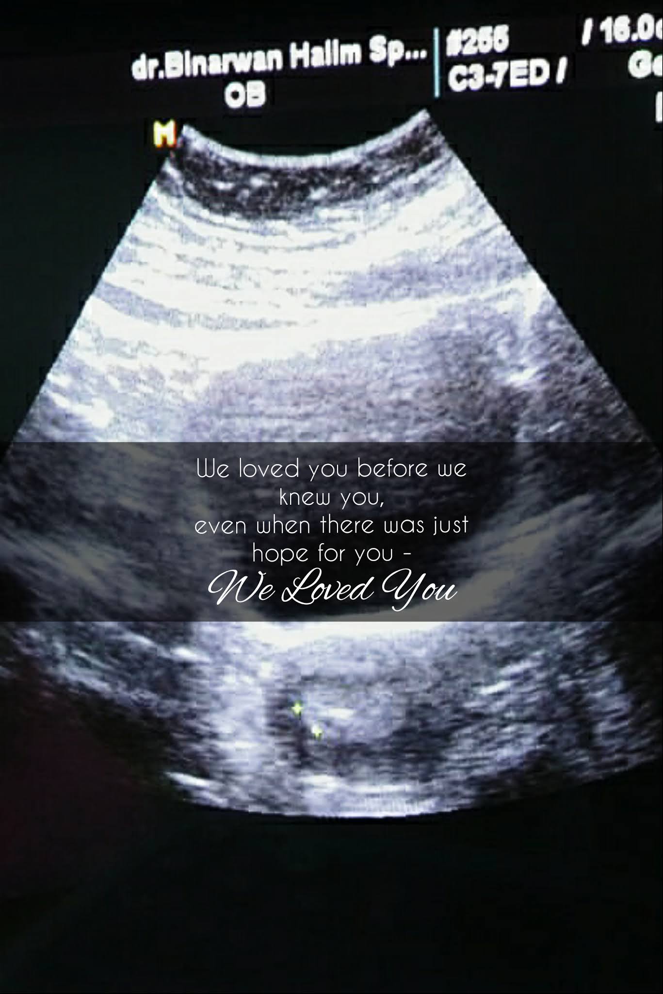 Frozen Embryo Transfer Day! Yay!