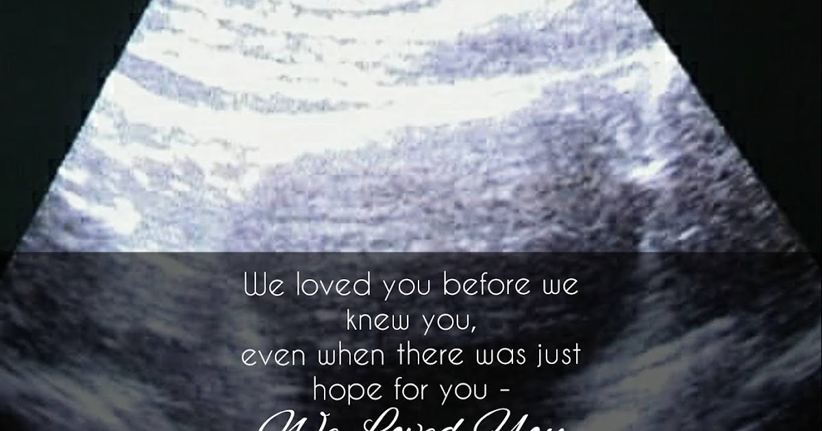 Frozen Embryo Transfer Day! Yay!