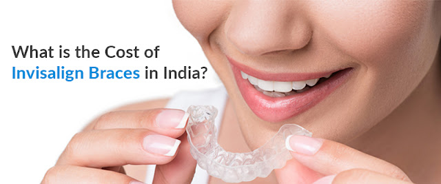 What is the Cost of Invisalign Braces in India
