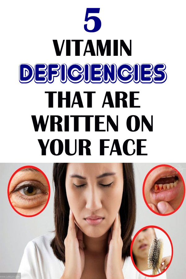 5 Vitamin Deficiency Signs That Show Up On Your Face