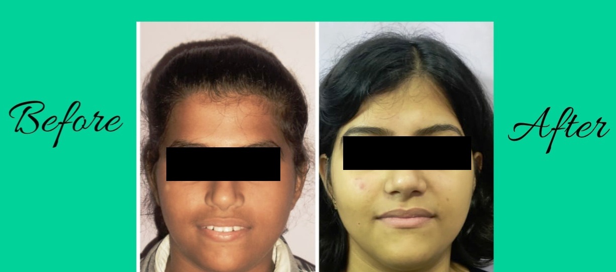 Best Dentist in Kolkata Best Dental Clinic in Kolkata Best Dental