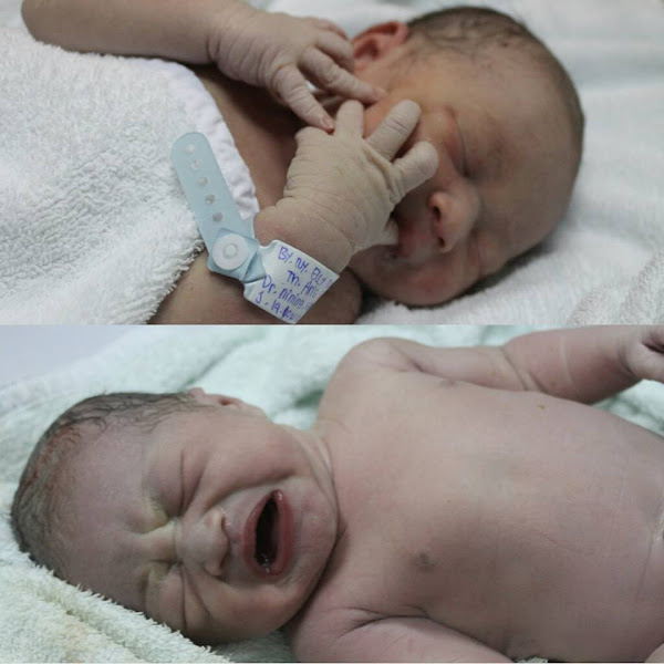 Perawatan Tali Pusar Bayi