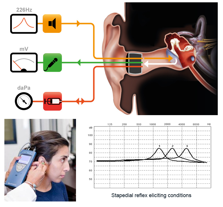 Medical Terms & Сlinical Сases Impedance audiometry
