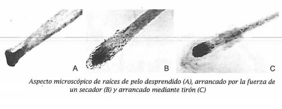 Medicina Y Quimica Forense Estudio De Pelos Y Cabellos