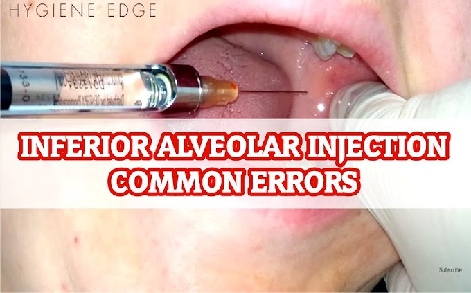 INFERIOR ALVEOLAR INJECTION : Common errors