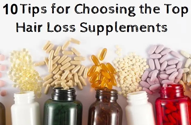  10 Tips for Choosing the Top Hair Loss Supplements