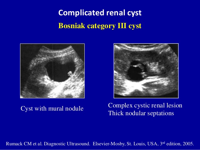 MEDICAL ULTRASOUND/RENAL CYST
