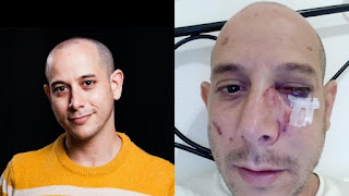 Elad Forgash. After and before the attack