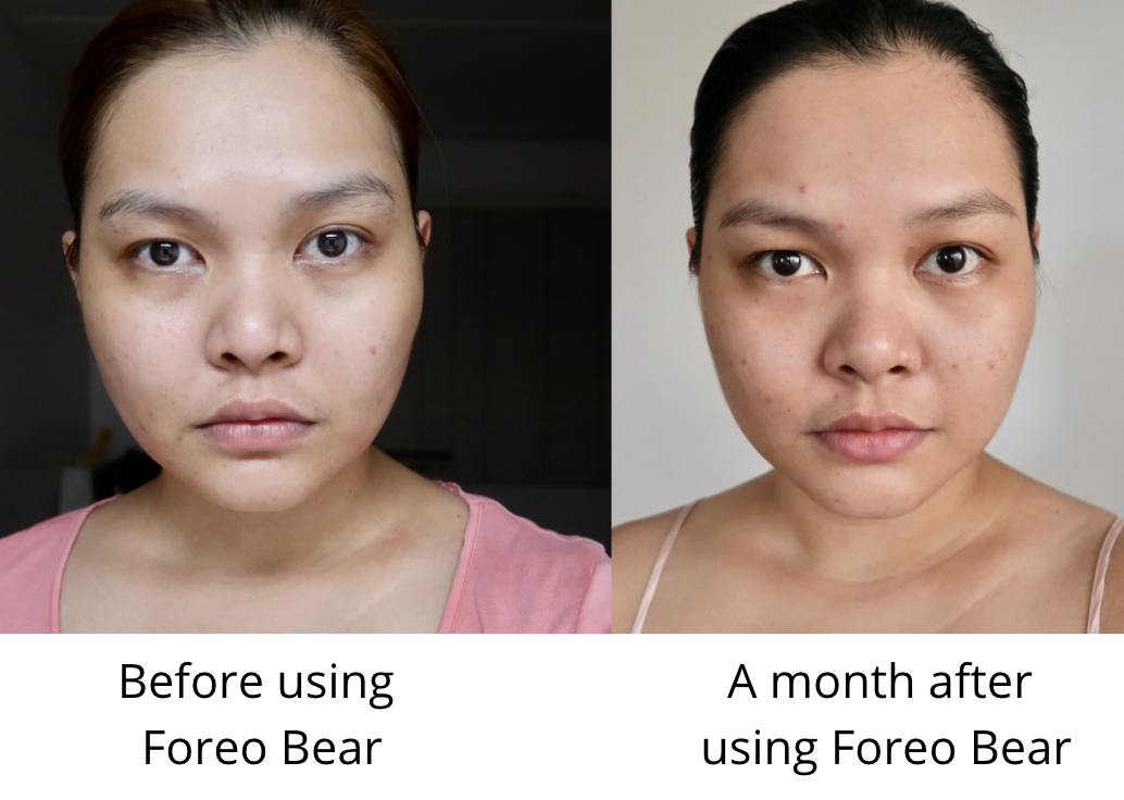 FOREO BEAR Facial Workout Microcurrent DEMO + Review 