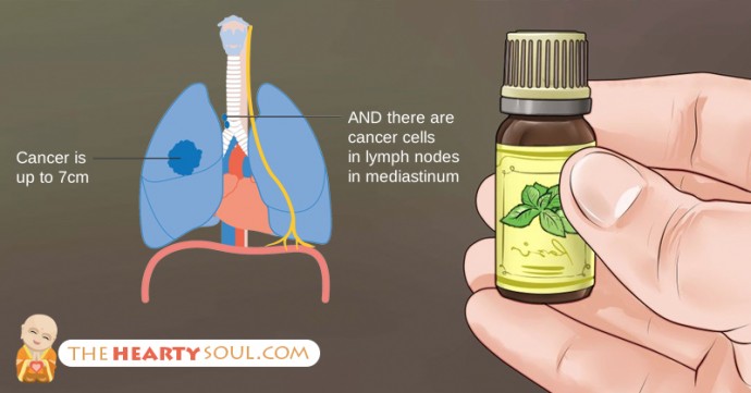 The Truth About Cancer And Essential Oils: What No Oncologist Will Tell You The Truth About Cancer And Essential Oils: What No Oncologist Will Tell You