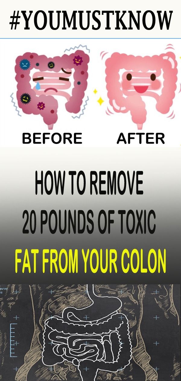 HOW TO REMOVE 20 POUNDS OF TOXIC FAT FROM YOUR COLON Best Health Tips