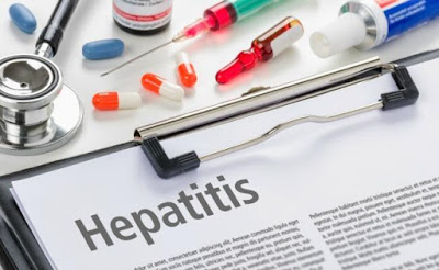 Hepatitis C Bisa Memicu Parkinson di Kemudian Hari