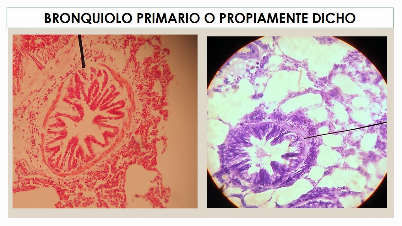 TEMAS MÉDICOS: HISTOLOGÌA PULMON