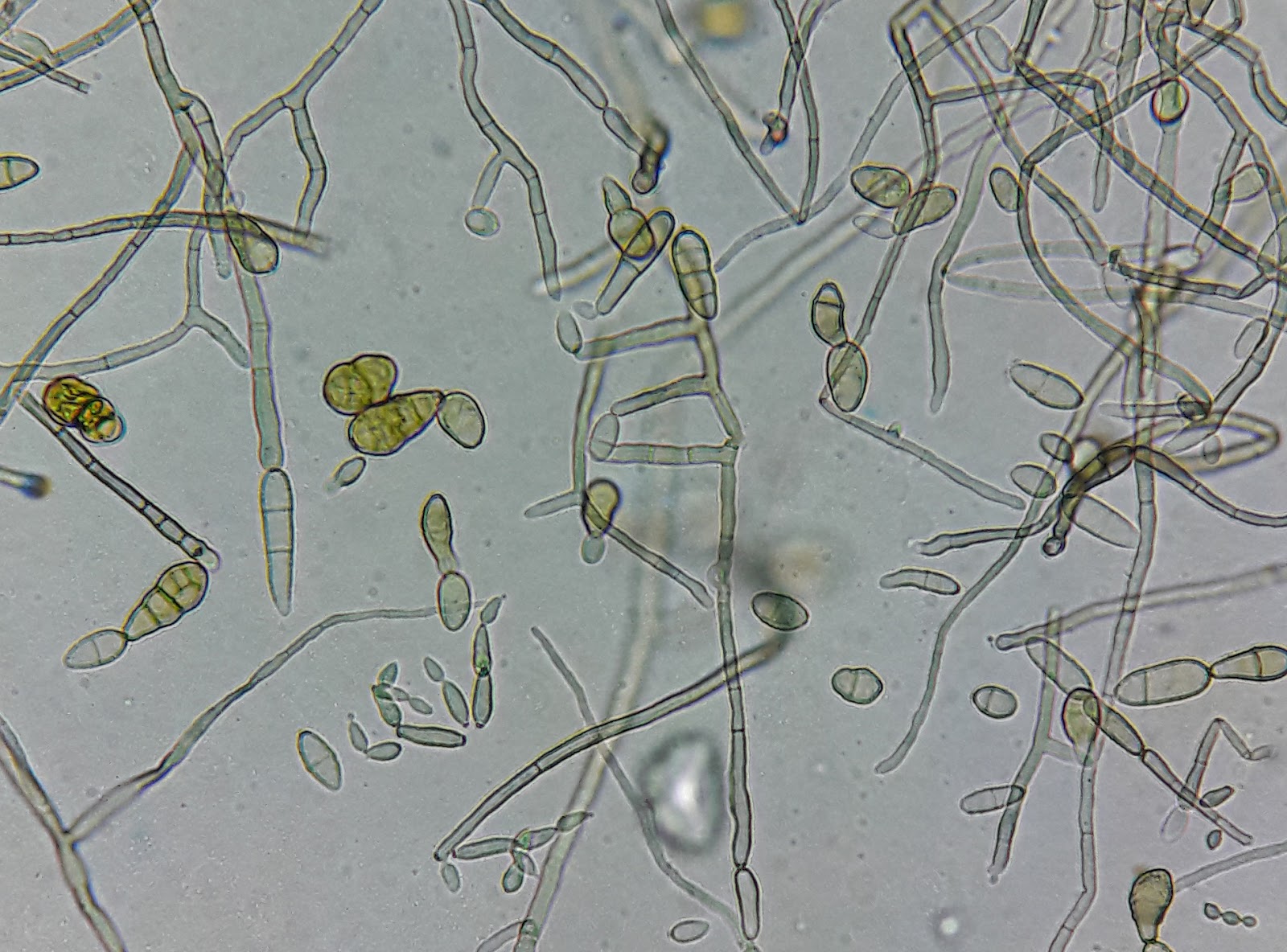 Нити мицелия споры. Cladosporium wemeckii. Кладоспориум и альтернария. Грибки Cladosporium resinae. Cladosporium herbarum конидии.