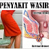 Obat wasir berdarah di apotik di jawa timur thumbnail