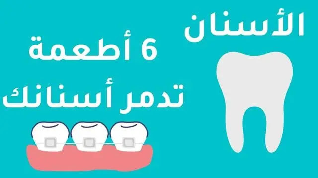 الآسنان : 6 أطعمة تدمرصحة أسنانك