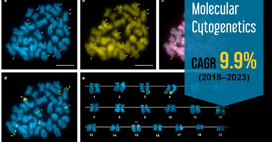 Advancements in Technology Augmenting Molecular Cytogenetics Market Growth